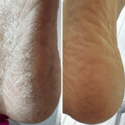 Крем від тріщин для рук та стоп з жожоба Resultum Anti Crack Cream Jojoba 25мл										