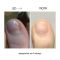 Регенеруюча олія проти оніхолізису NAILSOFTHEDAY ONISTOP  15мл