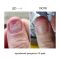 Регенеруюча олія проти оніхолізису NAILSOFTHEDAY ONISTOP  8мл