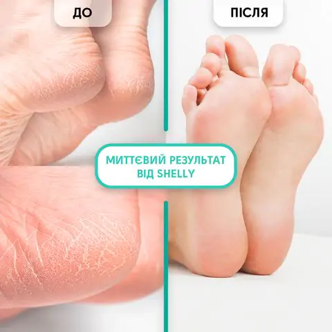 Гель-кератолітик Shelly М'яке лезо для видалення мозолів і натоптишів 200 мл